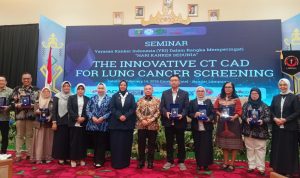 YKI Lampung Perkenalkan Skrining Kanker Paru Berbasis AI, Akurasi Capai 96 Persen